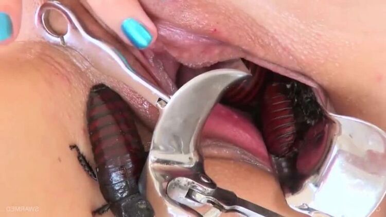 Unknown - Speculum vaginal examination extreme