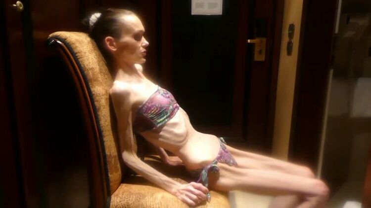 Anorexic 2621-denisa k5B2x