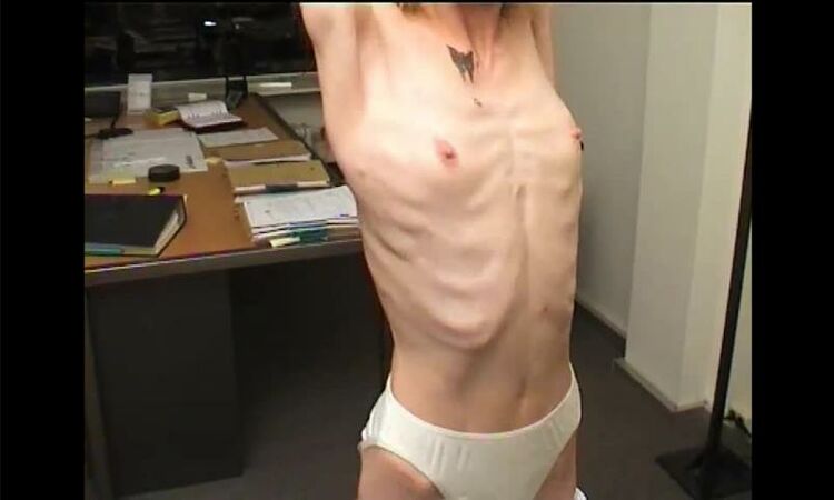 Anorexic 1236-suse2