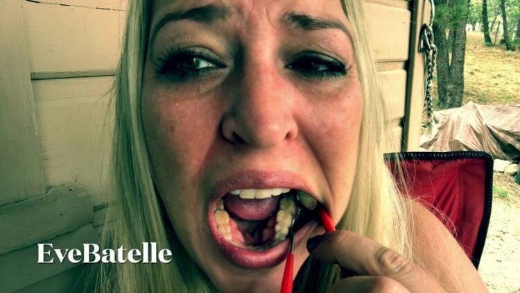 eve batelle tongue depressor and full mouth exam