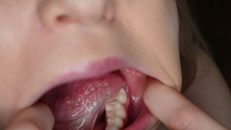 SOFIE SKYE – Teeth And Molars Tour Dental History – Femdom Pov