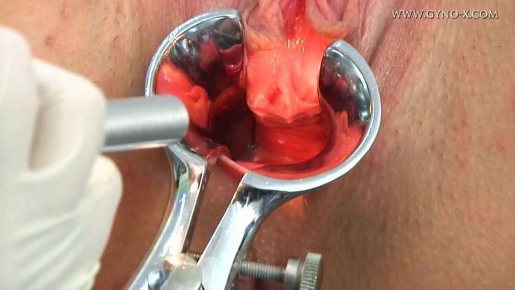 Medical Procedures - masturbation porn | Gyno-X - Gina - Gyno Exam - gyno - masturbation porn | medical