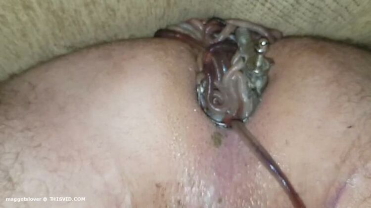 Maggots Penetration In Stretching Speculum Asshole My Husband