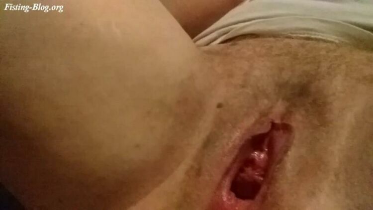 Fisting my hairy pussy – Braindeadbetty [updated: 2023-04-15]