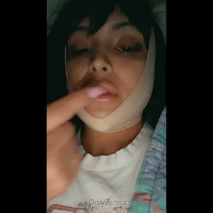 Elisa - ellamon / Onlyfans Ellamon - good morning lovers this is me a few hours after surgery tuesday night make sure to see 22-04-2021 - Fetish [updated: 2024-02-07]