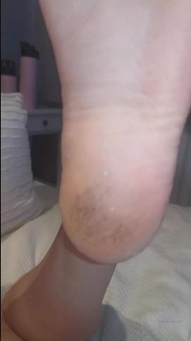 elizabethsfeet 19-04-2020 Need someone to moisturise my feet [updated: 2024-09-09]