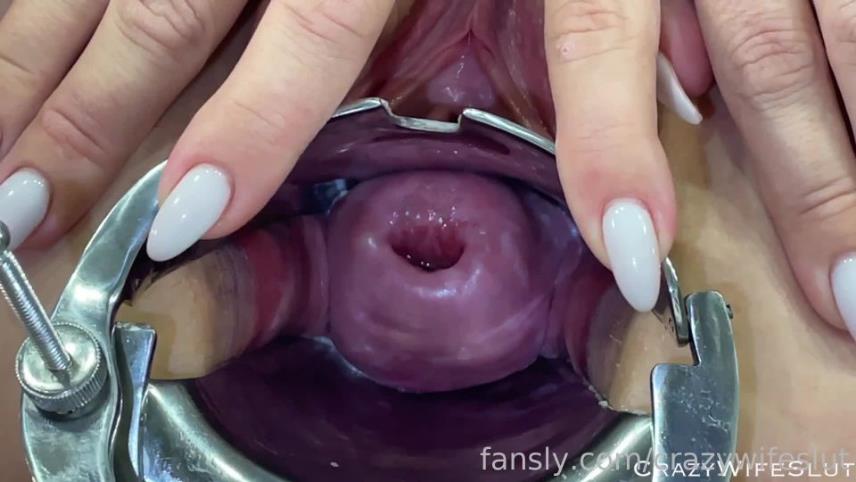 CrazyWifeSlut - 09-10-2022-435383483880189952-Glass dildo in my #cervix ?????? #fyp #speculum [updated: 2024-10-01]