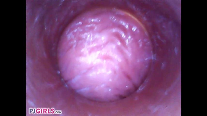 RAW Endoscopic Video [updated: 2024-10-09]