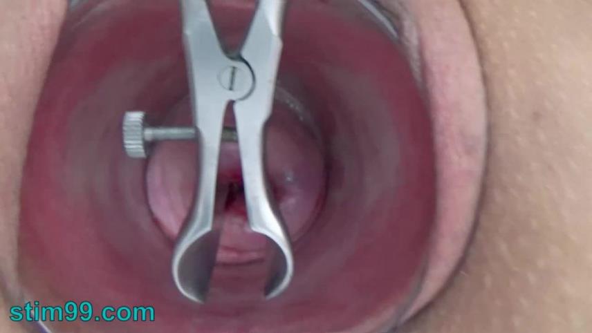 Stim99 – Open Cervix with Speculum and Semen Insertion in Uterus [updated: 2024-10-10]