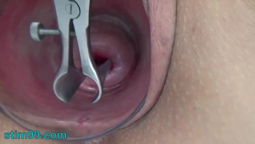 Stim99 – Open Cervix with Speculum and Semen Insertion in Uterus [updated: 2024-10-15]