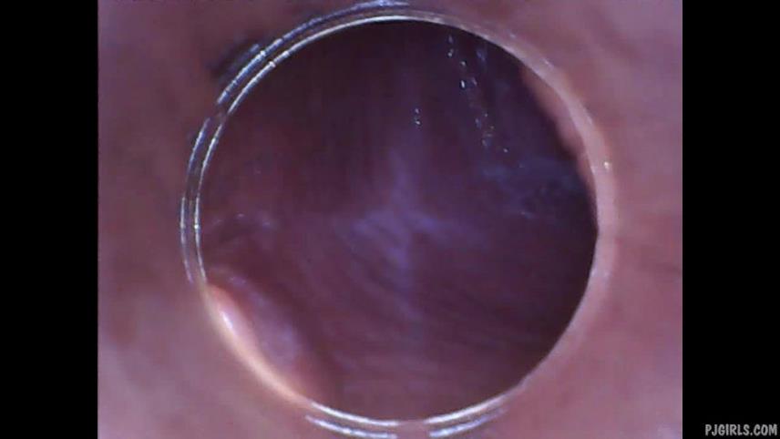 RAW endoscopic video [updated: 2024-10-30]