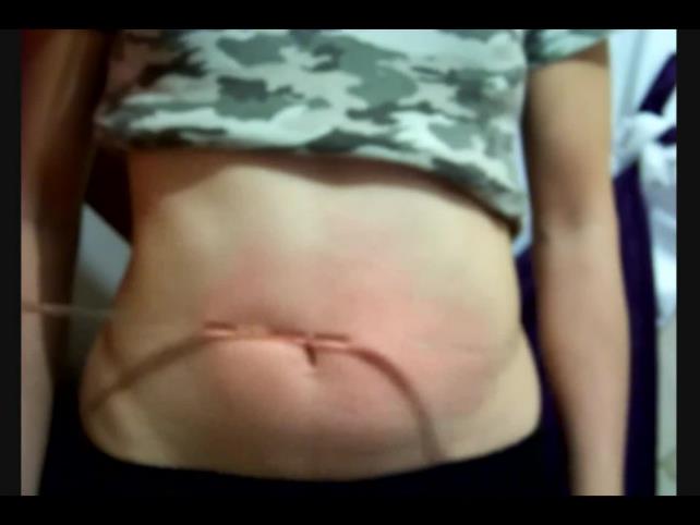 The first video of paula at 18 years old belly punch xxx [updated: 2024-11-11]